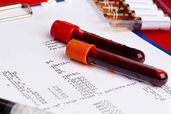 Comment se déroule le DPE ?